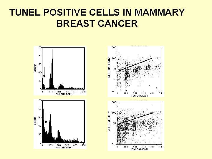  TUNEL POSITIVE CELLS IN MAMMARY BREAST CANCER 