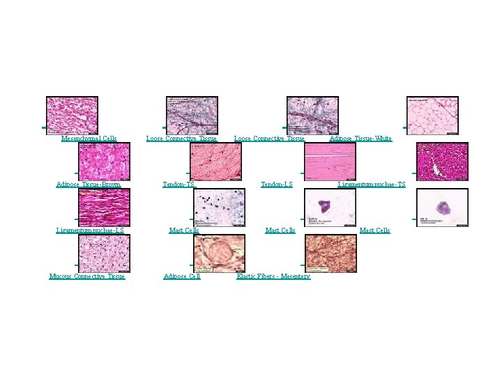  Mesenchymal Cells Loose Connective Tissue Adipose Tissue-White Adipose Tissue-Brown Tendon-TS Tendon-LS Ligamentum nuchae-TS
