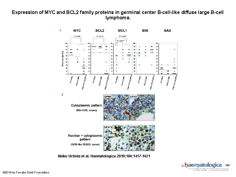 Expression of MYC and BCL 2 family proteins in germinal center B-cell-like diffuse large