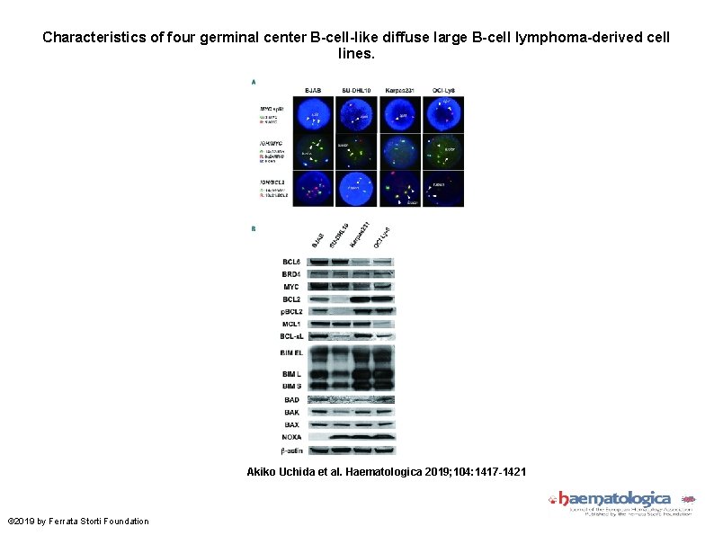 Characteristics of four germinal center B-cell-like diffuse large B-cell lymphoma-derived cell lines. Akiko Uchida