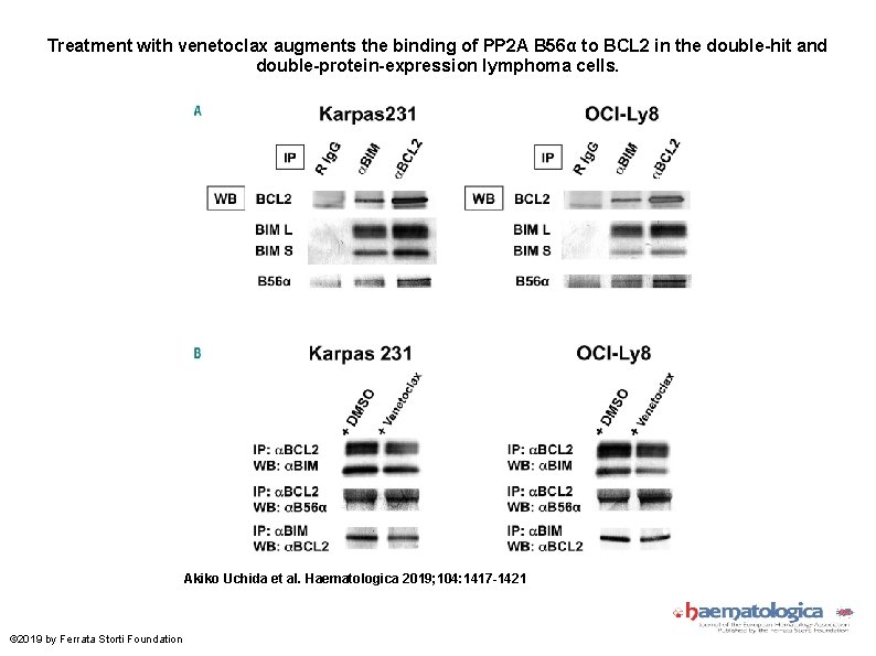Treatment with venetoclax augments the binding of PP 2 A B 56α to BCL