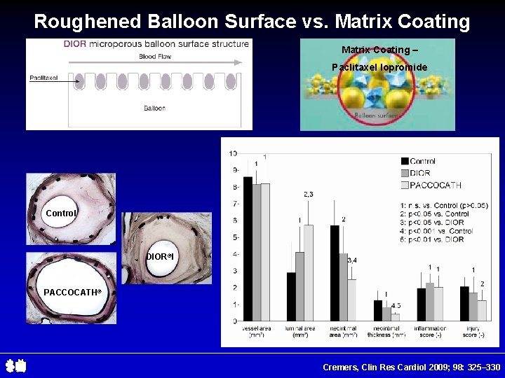 Roughened Balloon Surface vs. Matrix Coating – Paclitaxel Iopromide Control DIOR®I PACCOCATH® Cremers, Clin