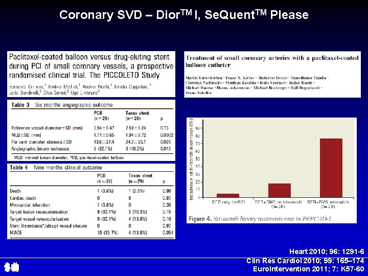 Coronary SVD – Dior. TM I, Se. Quent. TM Please Heart 2010; 96: 1291