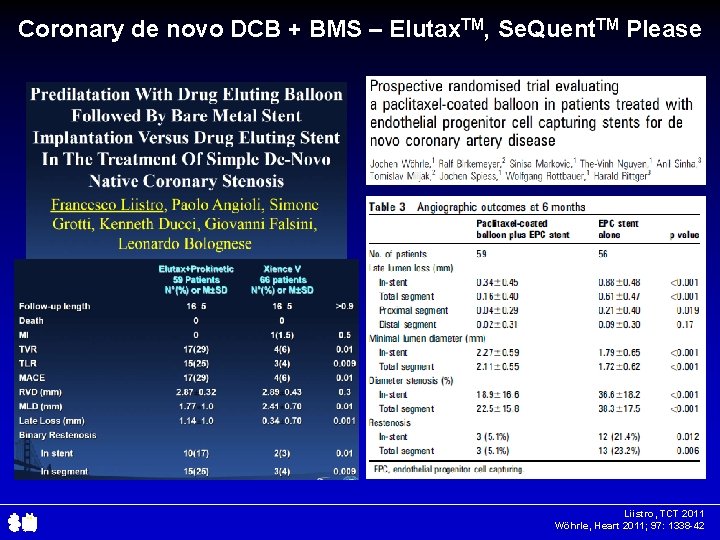 Coronary de novo DCB + BMS – Elutax. TM, Se. Quent. TM Please Liistro,