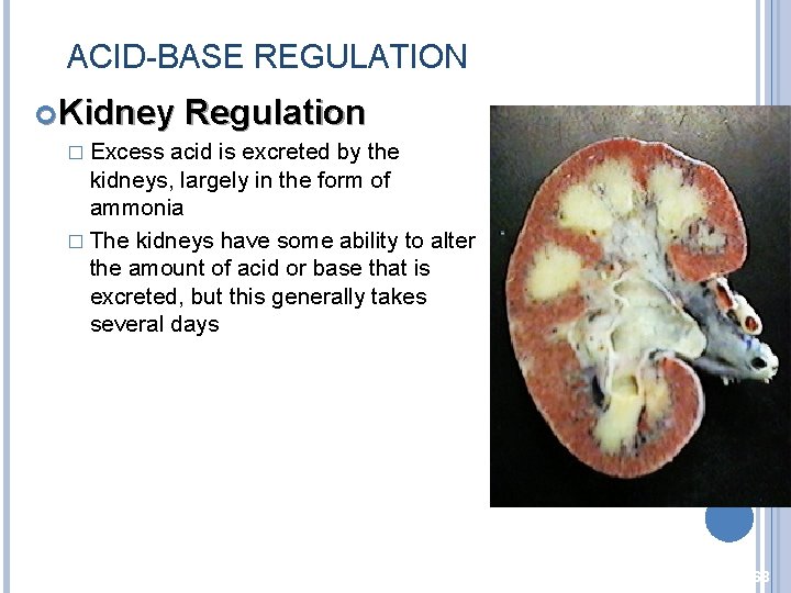 ACID-BASE REGULATION Kidney Regulation � Excess acid is excreted by the kidneys, largely in
