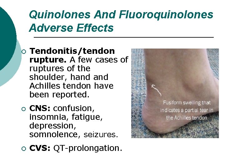 Quinolones And Fluoroquinolones Adverse Effects ¡ ¡ ¡ Tendonitis/tendon rupture. A few cases of
