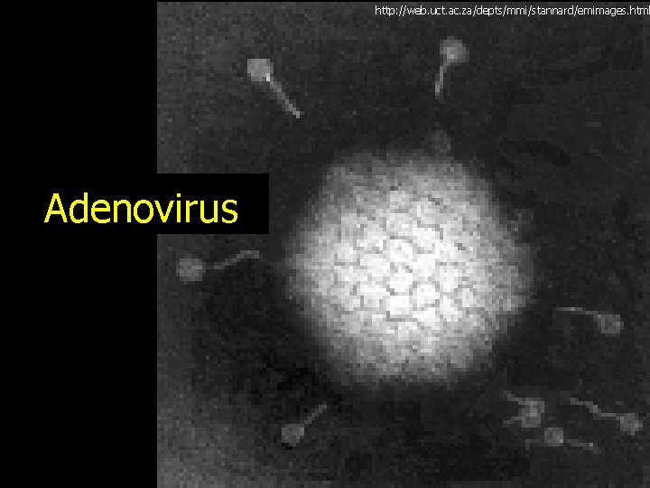 http: //web. uct. ac. za/depts/mmi/stannard/emimages. html Adenovirus 