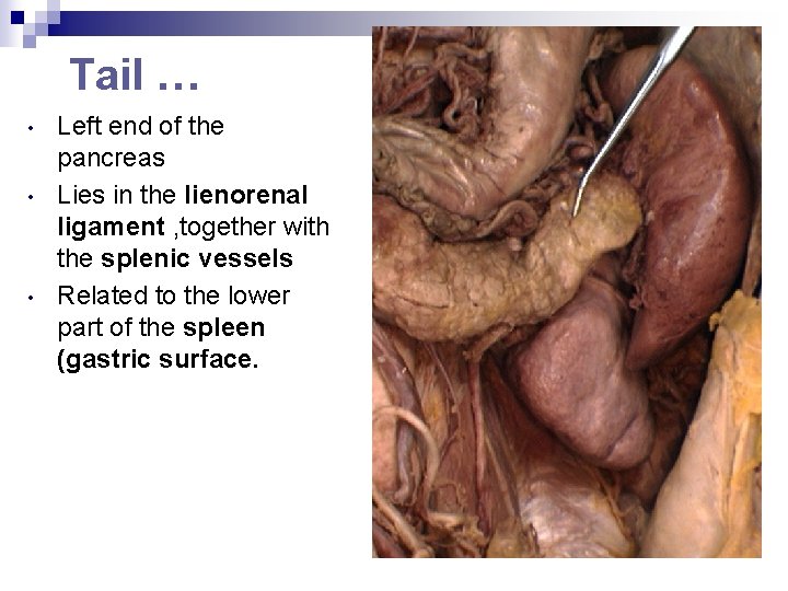 Tail … • • • Left end of the pancreas Lies in the lienorenal