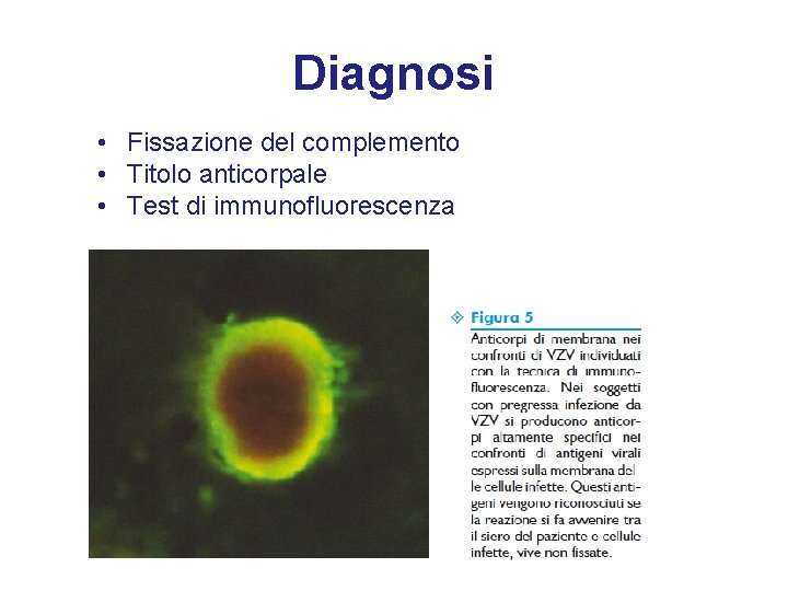 Diagnosi • Fissazione del complemento • Titolo anticorpale • Test di immunofluorescenza 