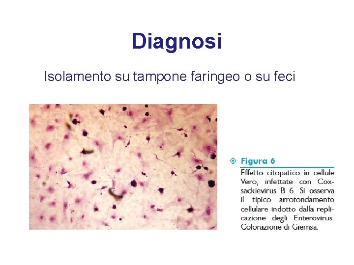 Diagnosi Isolamento su tampone faringeo o su feci 