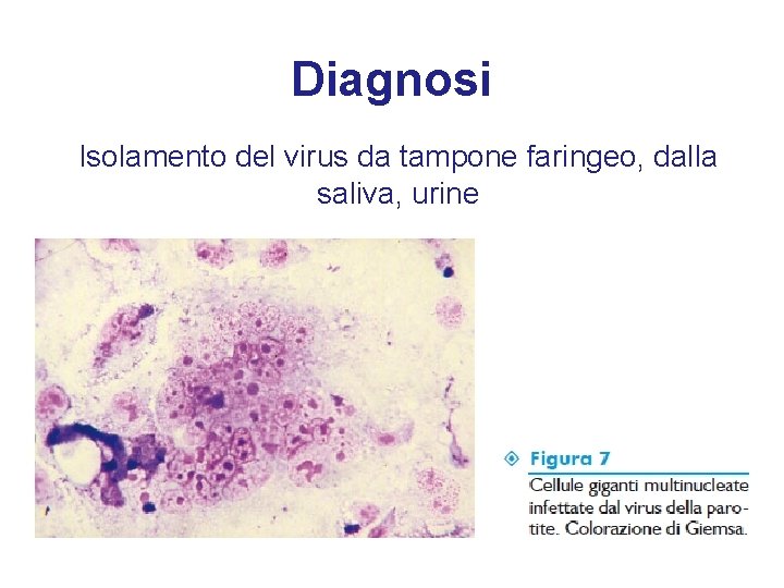 Diagnosi Isolamento del virus da tampone faringeo, dalla saliva, urine 