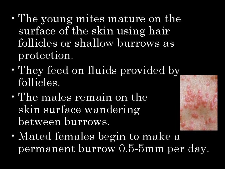  • The young mites mature on the surface of the skin using hair