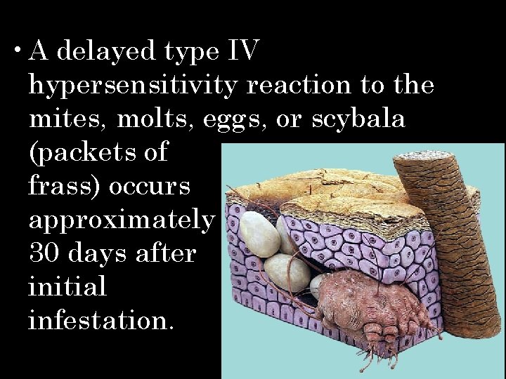  • A delayed type IV hypersensitivity reaction to the mites, molts, eggs, or