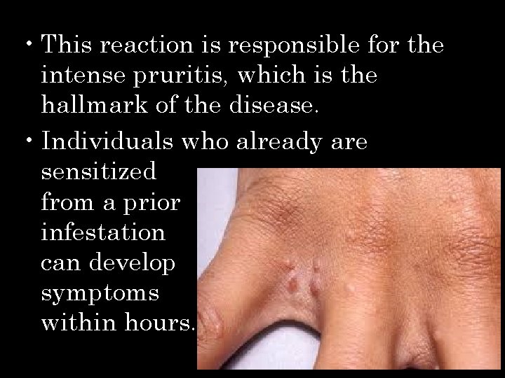  • This reaction is responsible for the intense pruritis, which is the hallmark