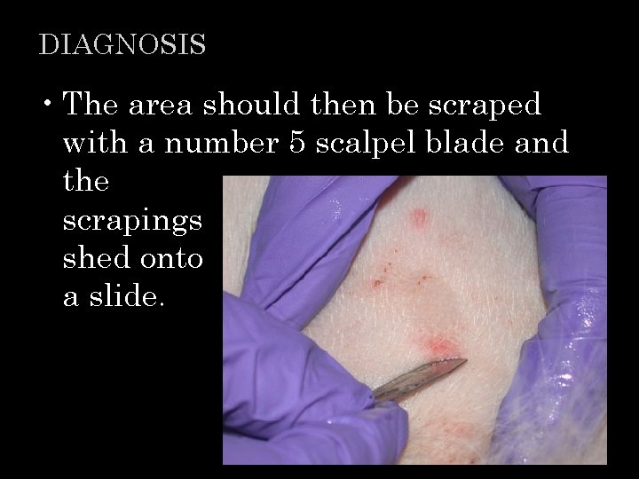 DIAGNOSIS • The area should then be scraped with a number 5 scalpel blade