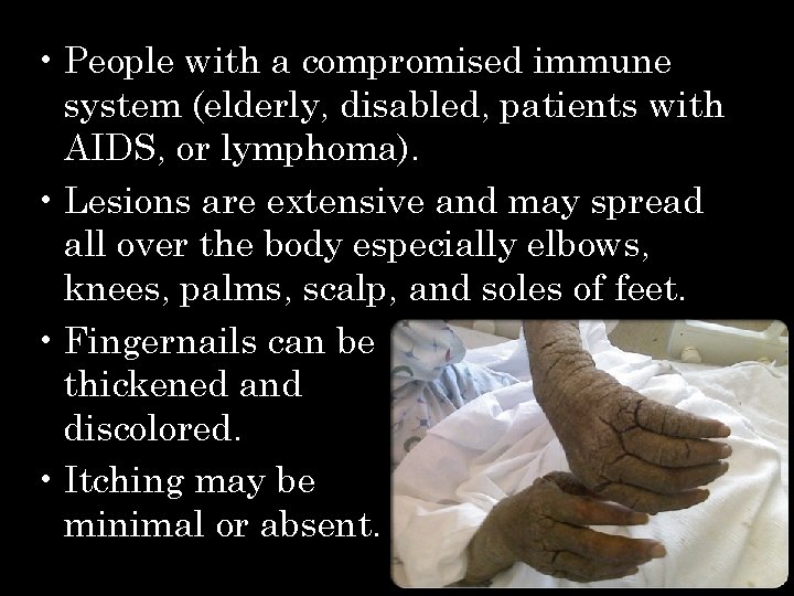  • People with a compromised immune system (elderly, disabled, patients with AIDS, or