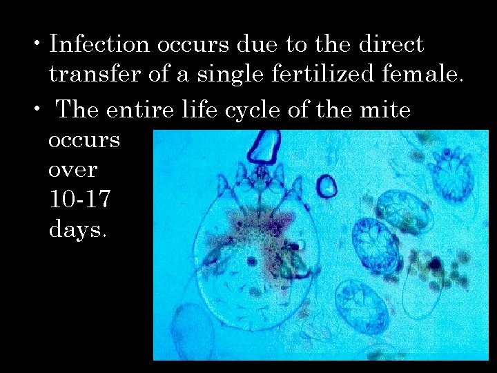  • Infection occurs due to the direct transfer of a single fertilized female.