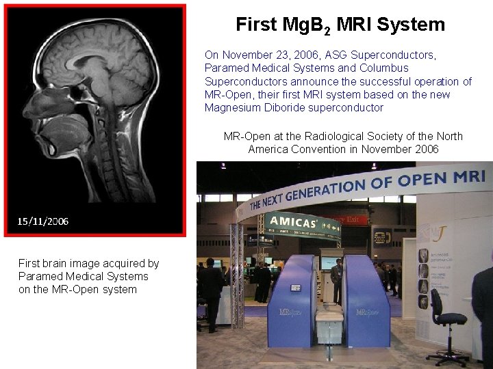First Mg. B 2 MRI System On November 23, 2006, ASG Superconductors, Paramed Medical