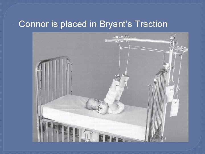  Connor is placed in Bryant’s Traction 