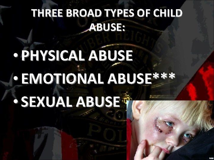 THREE BROAD TYPES OF CHILD ABUSE: • PHYSICAL ABUSE • EMOTIONAL ABUSE*** • SEXUAL