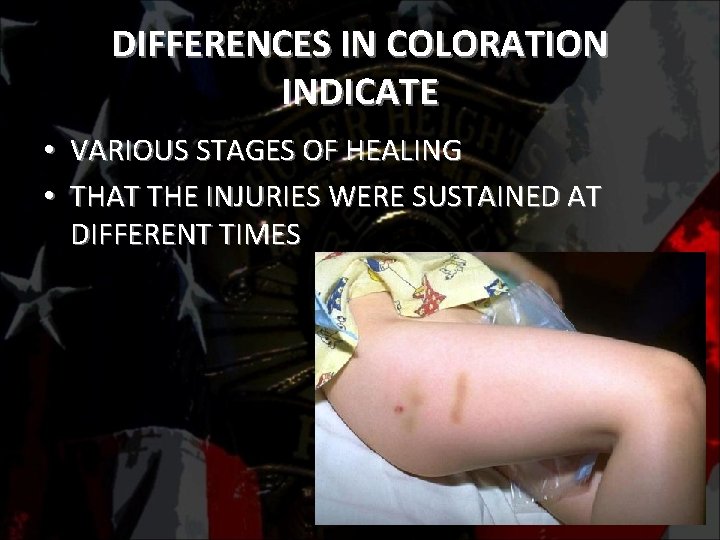 DIFFERENCES IN COLORATION INDICATE • VARIOUS STAGES OF HEALING • THAT THE INJURIES WERE