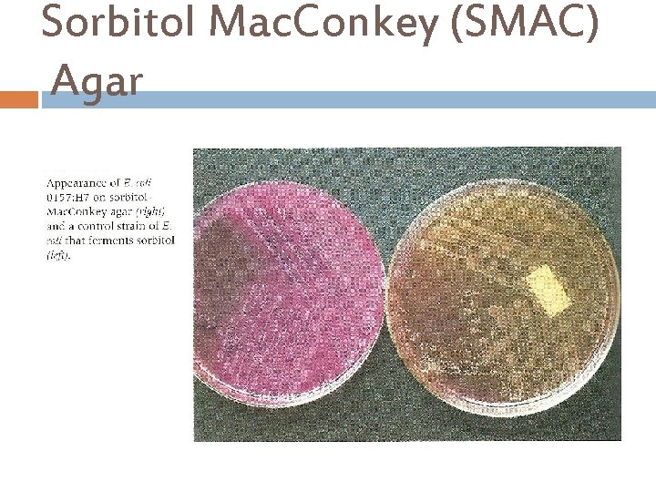 Sorbitol Mac. Conkey (SMAC) Agar 