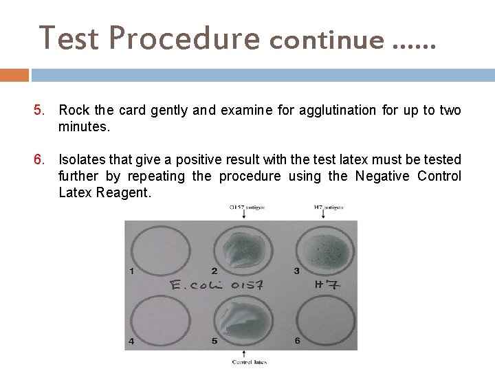 Test Procedure continue …… 5. Rock the card gently and examine for agglutination for
