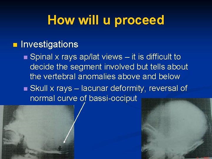 How will u proceed n Investigations Spinal x rays ap/lat views – it is