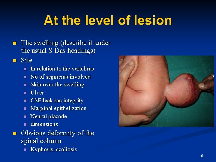 At the level of lesion n n The swelling (describe it under the usual