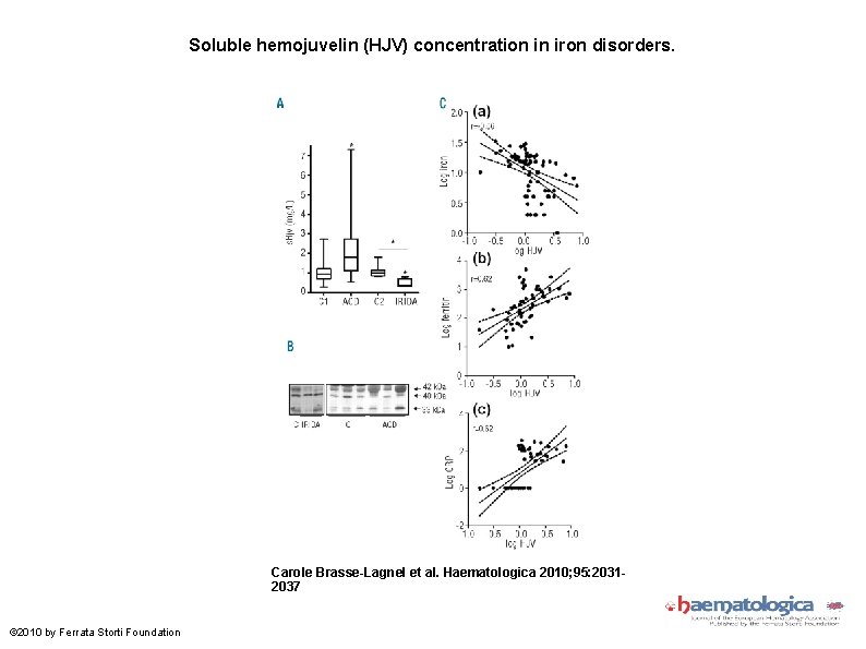 Soluble hemojuvelin (HJV) concentration in iron disorders. Carole Brasse-Lagnel et al. Haematologica 2010; 95: