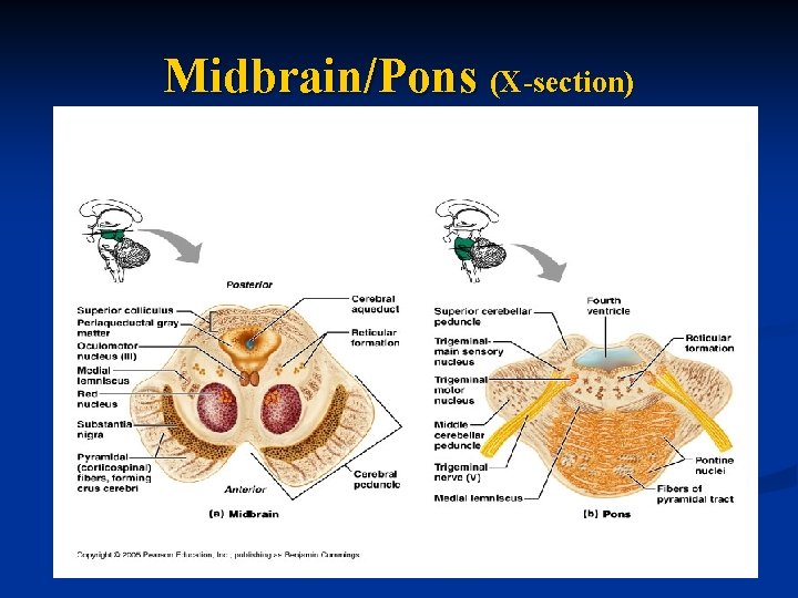 Midbrain/Pons (X-section) 
