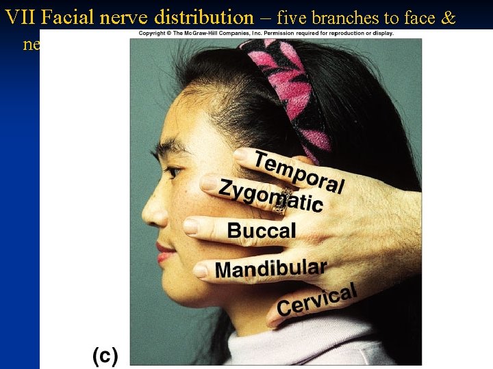 VII Facial nerve distribution – five branches to face & neck 