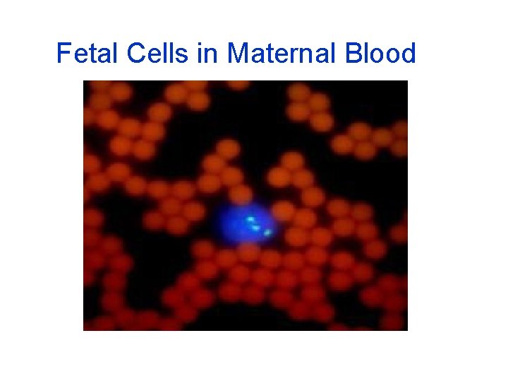 Fetal Cells in Maternal Blood 
