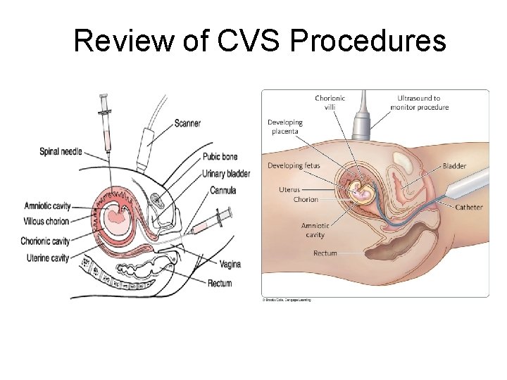 Review of CVS Procedures 