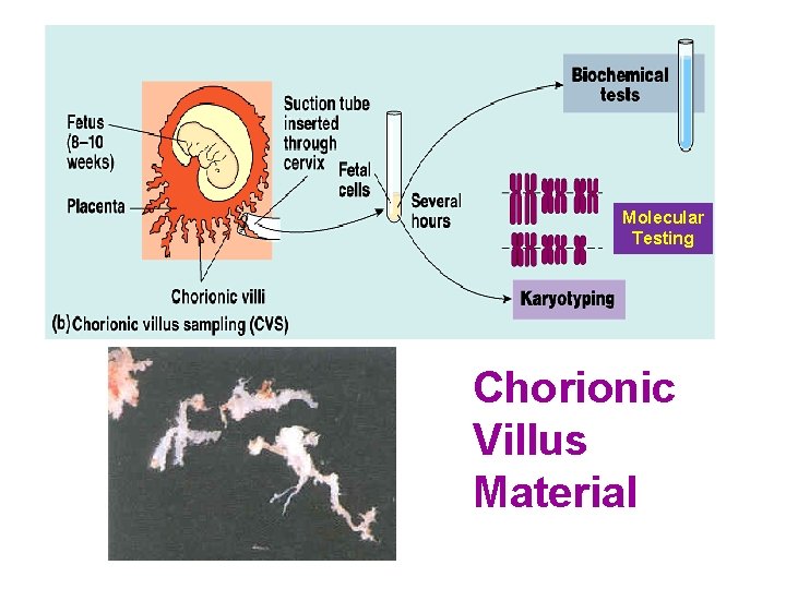 Molecular Testing Chorionic Villus Material 