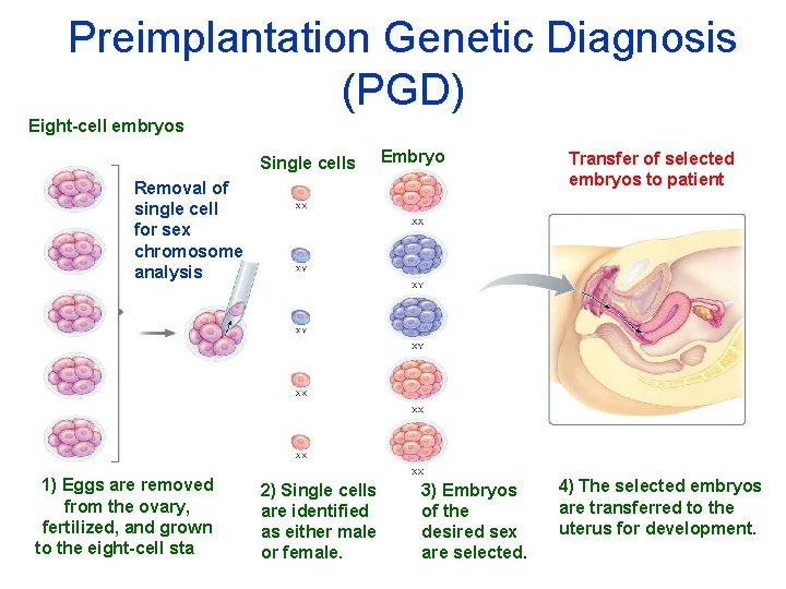 Preimplantation Genetic Diagnosis (PGD) Eight-cell embryos Single cells Embryos Removal of single cell for