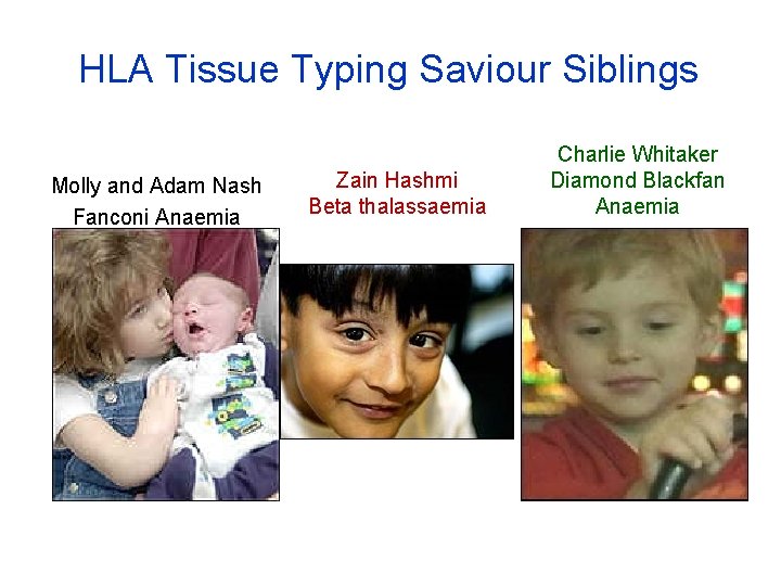 HLA Tissue Typing Saviour Siblings Molly and Adam Nash Fanconi Anaemia Zain Hashmi Beta