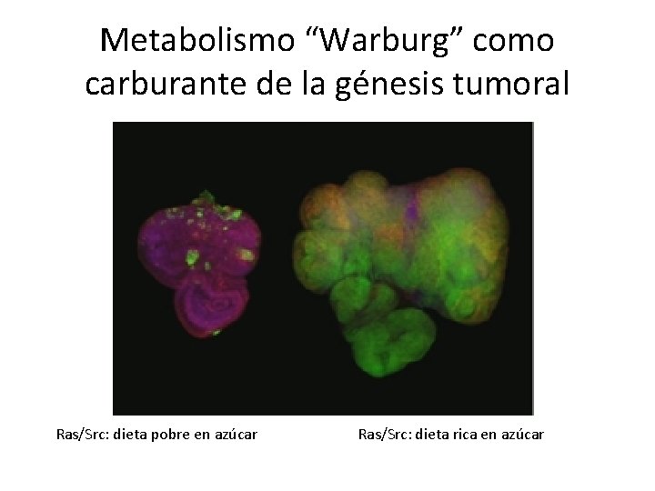 Metabolismo “Warburg” como carburante de la génesis tumoral Ras/Src: dieta pobre en azúcar Ras/Src: