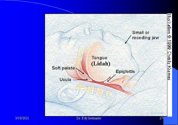 (Lidah) 3/10/2021 Dr. Edy hermanto 27 