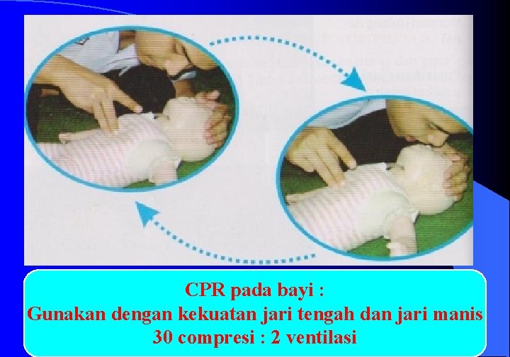 CPR pada bayi : Gunakan dengan kekuatan jari tengah dan jari manis 3/10/2021 Dr.