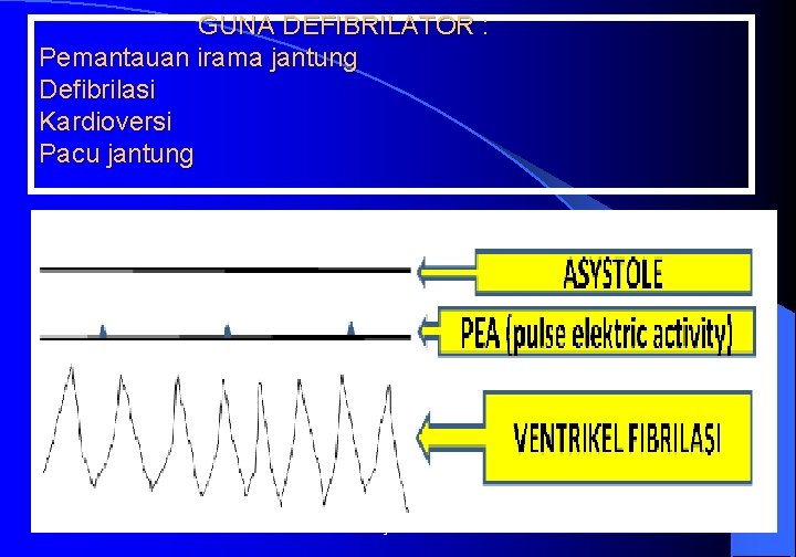 GUNA DEFIBRILATOR : Pemantauan irama jantung Defibrilasi Kardioversi Pacu jantung 3/10/2021 Dr. Edy hermanto