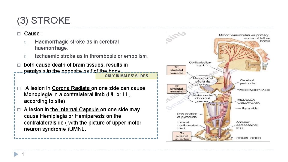 (3) STROKE � � Cause : a. Haemorrhagic stroke as in cerebral haemorrhage. b.