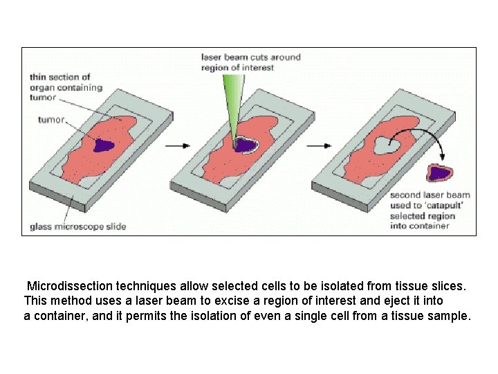  Microdissection techniques allow selected cells to be isolated from tissue slices. This method