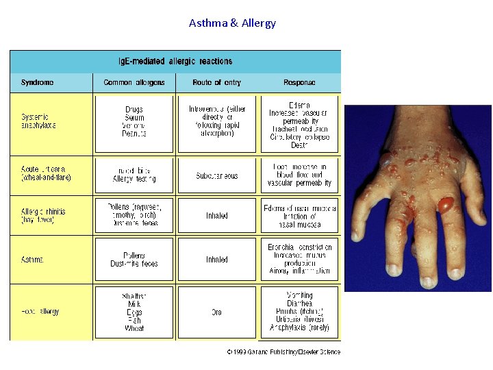 Asthma & Allergy 