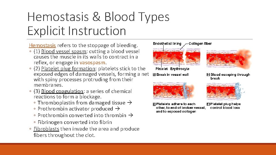Hemostasis & Blood Types Explicit Instruction Hemostasis refers to the stoppage of bleeding. ◦ Hemostasis & Blood Types Explicit Instruction Hemostasis refers to the stoppage of bleeding. ◦