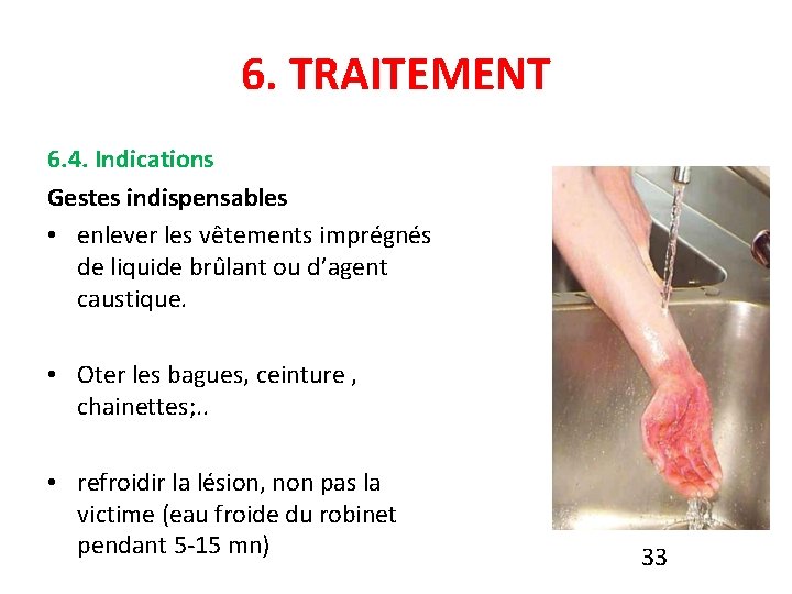 6. TRAITEMENT 6. 4. Indications Gestes indispensables • enlever les vêtements imprégnés de liquide