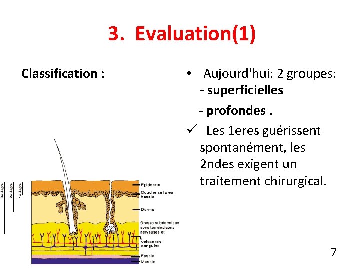 3. Evaluation(1) Classification : • Aujourd'hui: 2 groupes: - superficielles - profondes. ü Les