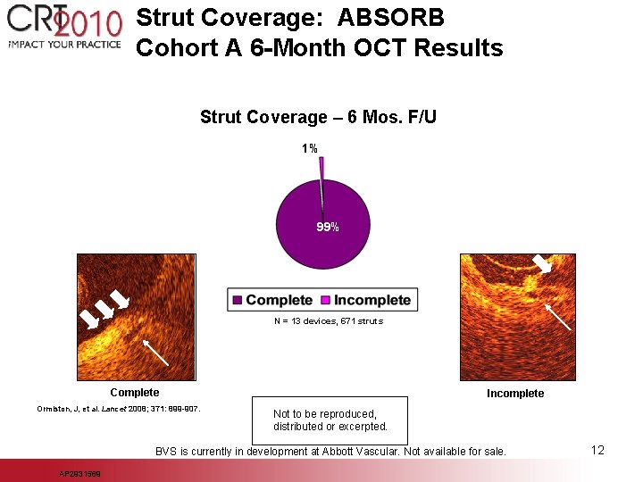 Strut Coverage: ABSORB Cohort A 6 -Month OCT Results Strut Coverage – 6 Mos.