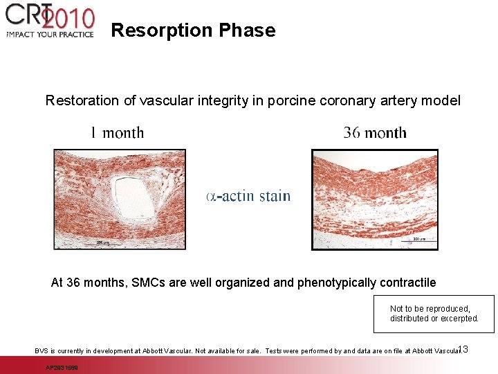 Resorption Phase Restoration of vascular integrity in porcine coronary artery model At 36 months,