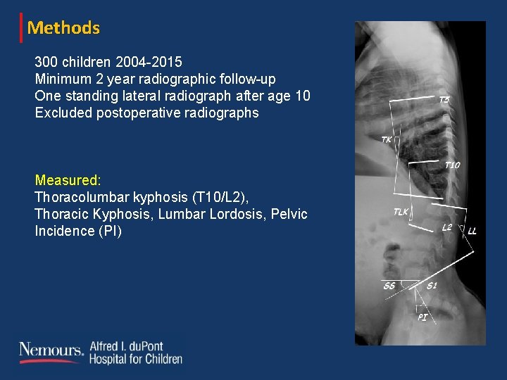 Methods 300 children 2004 -2015 Minimum 2 year radiographic follow-up One standing lateral radiograph Methods 300 children 2004 -2015 Minimum 2 year radiographic follow-up One standing lateral radiograph
